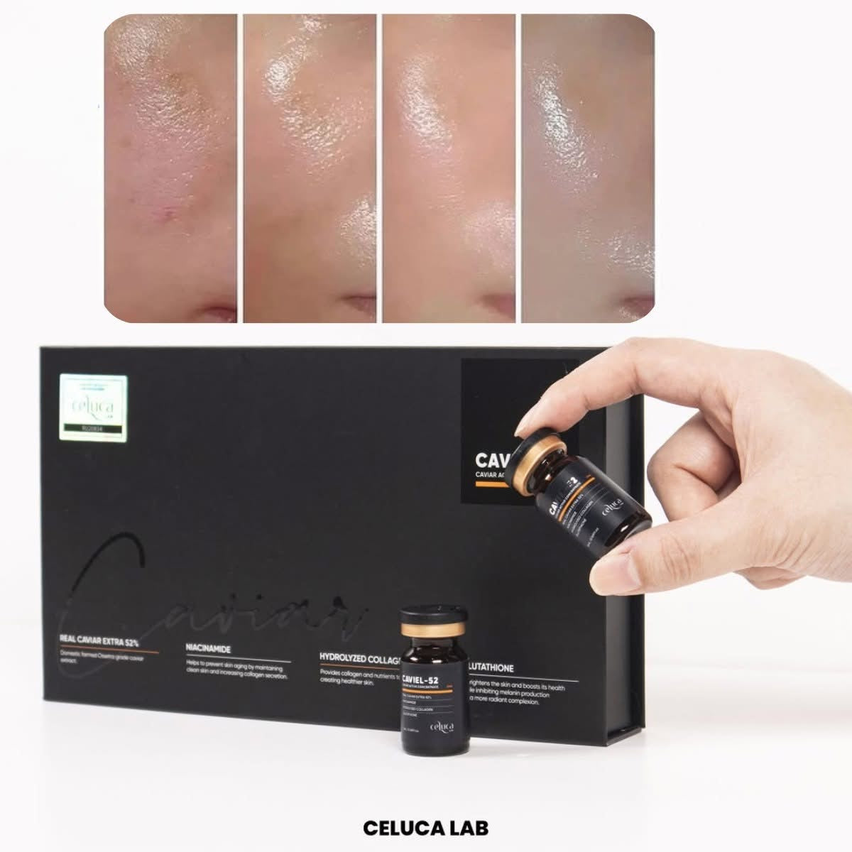 TẾ BÀO GỐC CELUCA