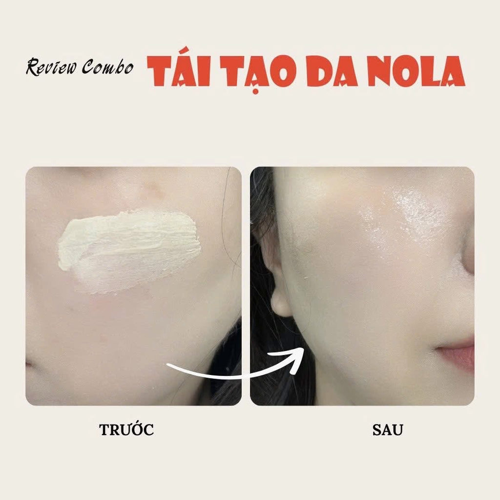 CẶP ĐÔI TÁI TẠO NOLA